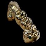 Sell Dental Gold for fast cash at Phoenix Pawn & Gold